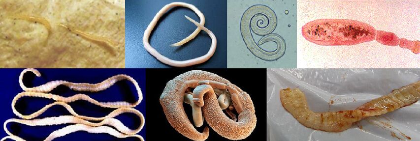 Différents types de parasites