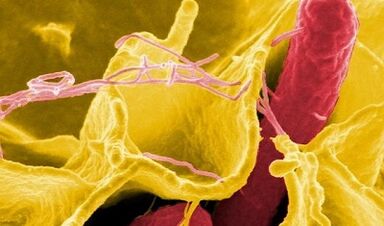 Signes de parasites dans le corps humain