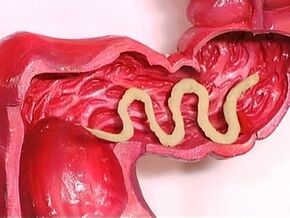 Parasites dans le corps humain, pourquoi ils apparaissent