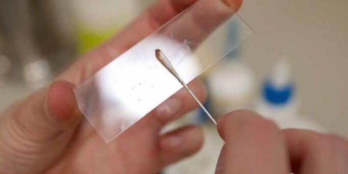 Grattage de la peau contre les parasites