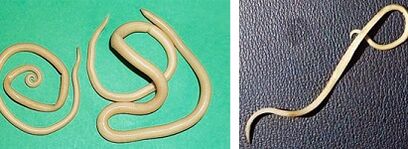 Quels parasites une personne peut-elle avoir 