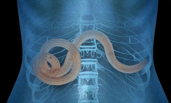 Parasite dans le corps humain